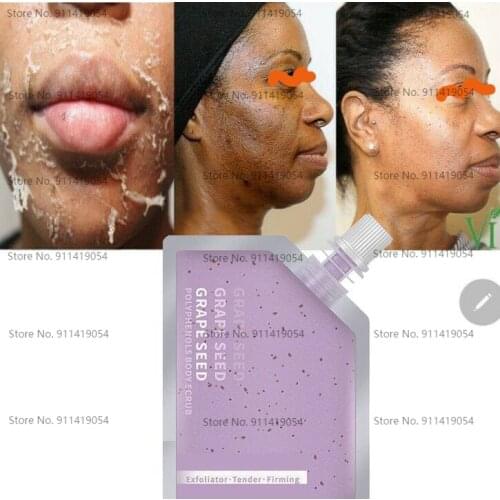100g Grape Pip Peeling Facial Skin Scrub Skin Peel To Remove Darkness for Whitening Skin Face Scrub Exfoliator