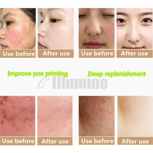 1KG Pure Snail Slime Mucus 1000ml Same As Snail Crawling On The Face Treatment Beauty Salon Equipment