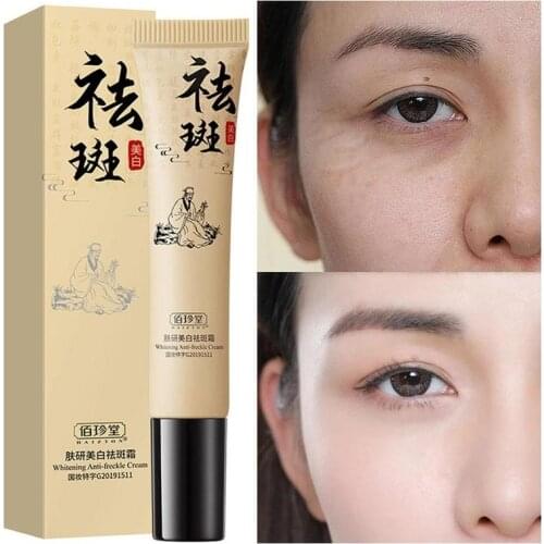 20g Effective Whitening Freckle Cream Remove Melasma Acne Spot Pigment Melanin Dark Spots Whitening Moisturizing Cream Skin Care
