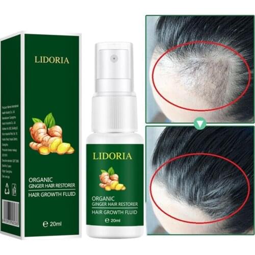 20ml Hair Growth Spray Ginger Extract Essence Spray Products Effective Hair Anti Roots Nourish Treatments Hair Hair Loss