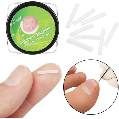 10pcs/set Ingrown Nail Pad Ortho Nail Filling Nail Groove Pad Ingrown Nail Corrector Ingrown Nail Artifact Foot Care Tool
