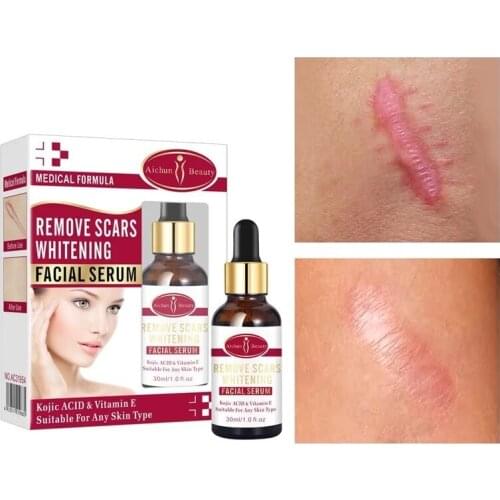 Acne Scar Stretch Marks Removal Essence Postpartum Skin repair Treatment Scar Nourish Whitening Moisturizing Care Serum