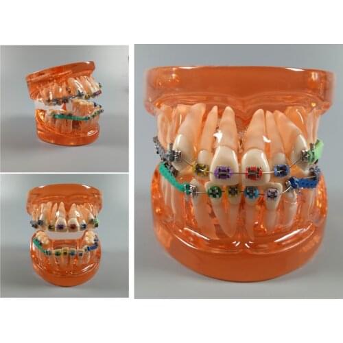 Orange Dental Study Model Orthodontic Demonstrate School Teaching Tool Crystal Translucent Ceramic