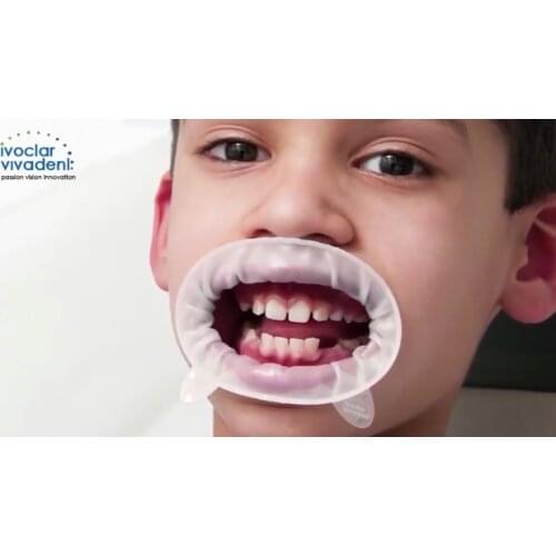 10Pcs OptraGate 3D Lip Cheek Retractor Small Szie White For Child Dental Ivoclar Vivadent