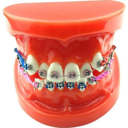 Orthodontic Dental Teeth Model With Brackets Chain Ties Arch Wire Dental Teaching Model
