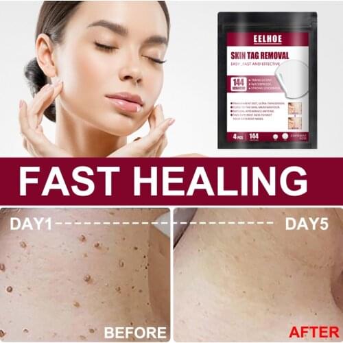 EELHOE Warts Remover Patches Acne Wart Treatments Pen Skin Tag Remover Corn Healing Skin Care Kits Body Antibacterial Patch