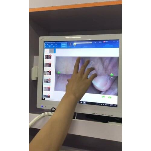A6M-X dental camera intraoral wireless touch screen odontologi instrumental dental dental chair spare parts
