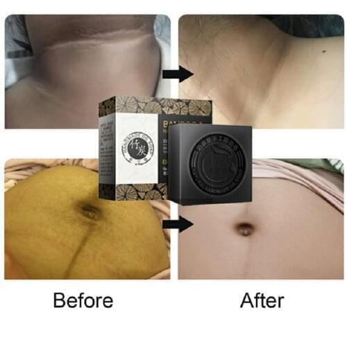 30pcs Women Private Intimate Bamboo Charcoal Whitening Soap Skin Cleansing Bleaching Remove Darkness Oil-control Face Body Care