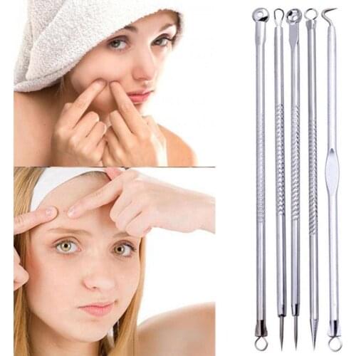 Blackhead remove5Pcs Pimple Blemish Comedone Acne Extractor Remover Tool Set Acne Extractor Remover Tool Set 18jun8