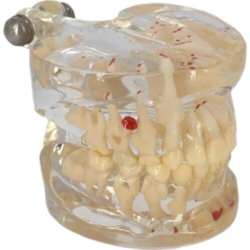 1pcs Child Tooth Model Human Teeth Model Transparent color Human Mouth Teeth Pathology Anatomical Model for Teaching display