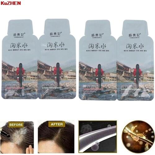 4pc Rice Hair Growth Shampoo Anti Hair Loss Treatment Serum Fast Growth Longer thicker Hair for Men Women Best Hair Care Product