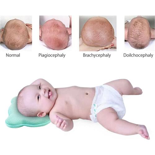 Fashion Brand New Solid Color Design Orthopedic Baby Pillow Against Deformation Flat Head Baby Soft Shaping Pillow