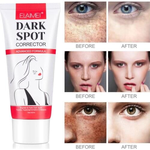 60ml Effective Whitening Freckle Cream Remove Melasma Acne Spot Pigment Melanin Dark Spots Pigmentation Moisturizing Gel