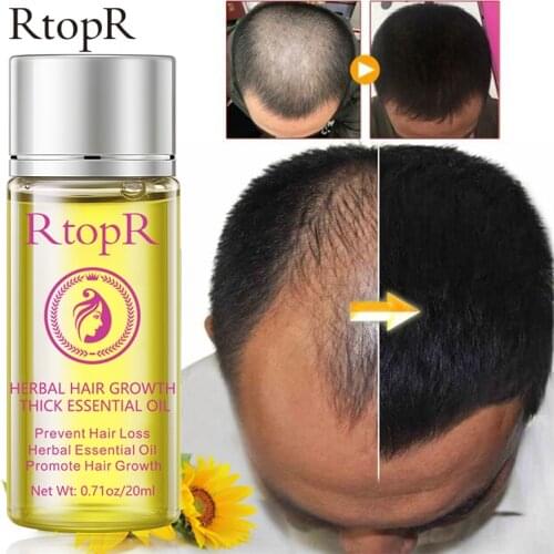 Hair Growth Products for Men Women Anti Hair Loss Treatment Promote Hair Regrowth Repair Nourish Hair Roots Essential Oil 20ml