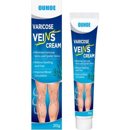 20g Varicose Veins Cream Treatment Vasculitis Phlebitis Spider Ointment Varicosity Angiitis Removal Medical Herbal Plaster Skin