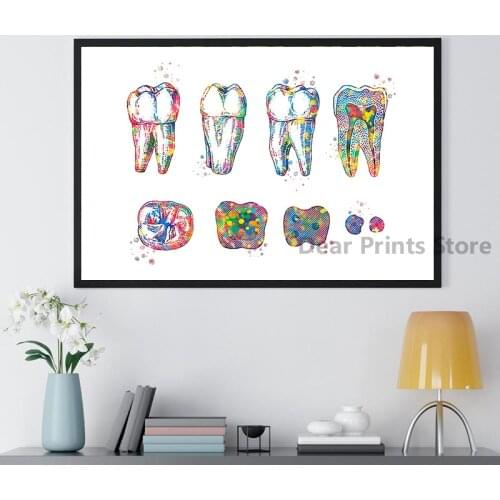 Tooth Implant Art Dental Crown Print Dentist Gift Tooth Anatomy Medical Wall Art Canvas Painting Picture Dental Clinic Decor