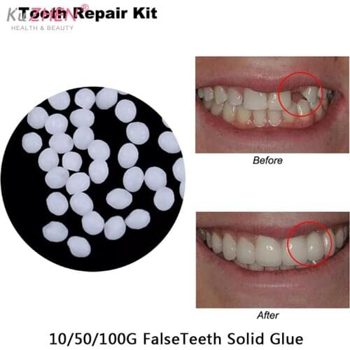 Resin FalseTeeth Solid Glue Temporary Tooth Repair Set Teeth And Gap Falseteeth Denture Adhesive Teeth Dentist 10g/50g/100g/Bag