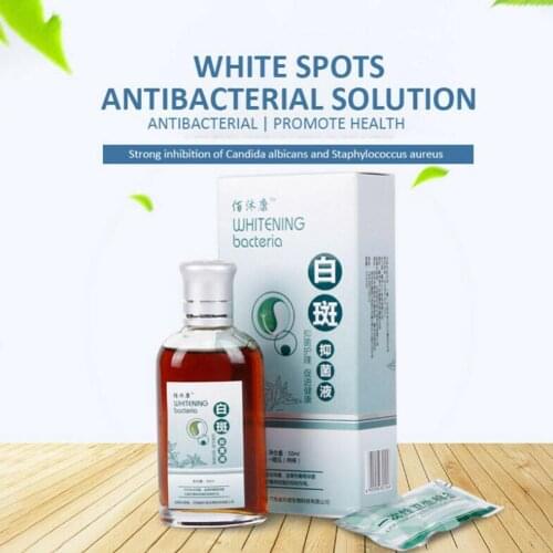 50ml Skin Treatment White Spot Disease Liquid Pigment Disease Melanin Treatment Vitiligo Promoting Skin Leukoplakia Linimen P7L9