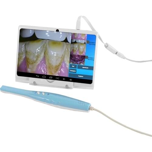 CF-688A OTG Intraoral Camera with high resolution 1/4 CMOS chip used on computer ,androis smart phone and tablet pc