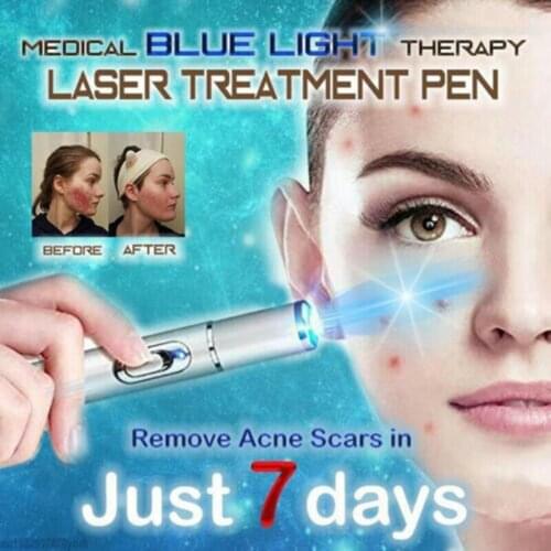 Blue Light Therapy Varicose Veins Treatment Laser Pen Soft Scar Wrinkle Removal Treatment Acne Laser Pen Massage Relax