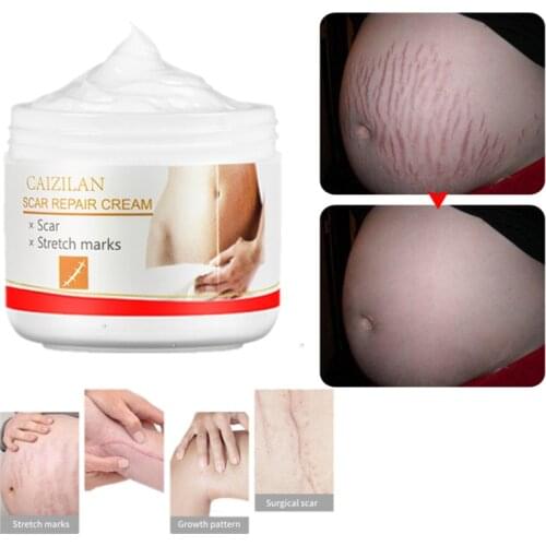 30ml peach kernel Stretch Marks Remover Cream Eliminate Pregnancy Scars Maternity Repair Anti Winkle Skin Firming Treatment