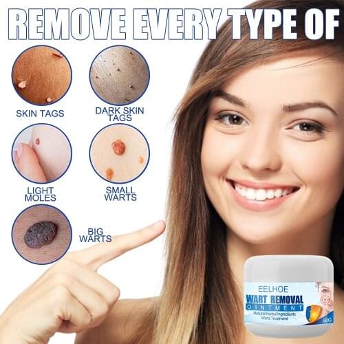 Wart Remover Safe Painless Skin Tags Removal Ointment Fast Acting Remover Cream for Warts Moles Corn for All Skins