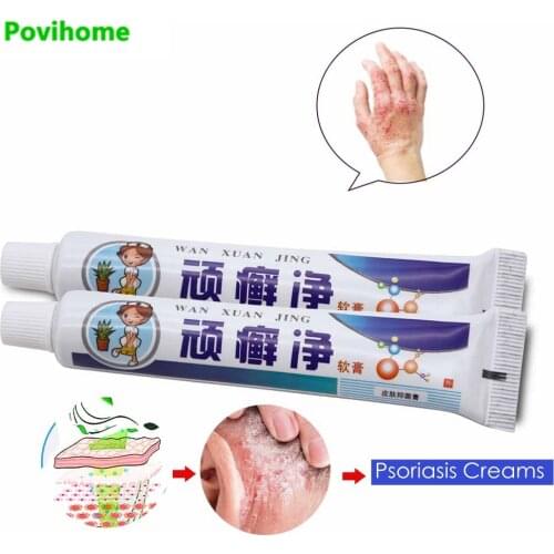 1pcs Herbal Ointment Psoriasi Eczma Cream Dermatitis Psoriasis Eczema Anti-itch Cream Anti-itch Natural Ointment Skin Treatment