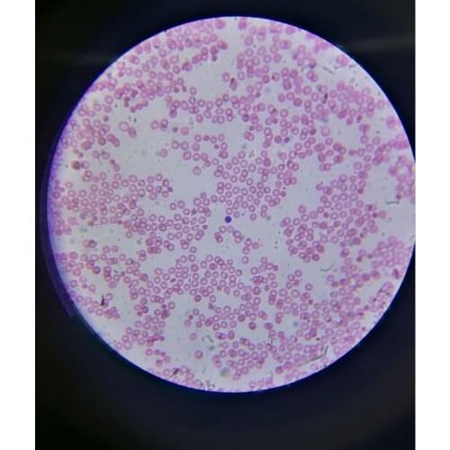 50pcs human prepared blood smear Microscope Glass Slides Prepared Biological slides Cover Slips in Wood Box