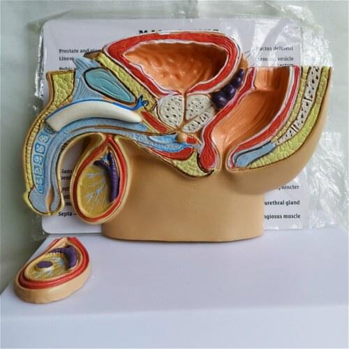 Male abdominal cavity Pathological model Explanation of doctor-patient pathology in health care medical teaching