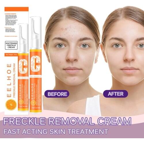 Freckle Remover Gel Vitamin C Whitening Anti-Freckle Cream Pencil o Effectively Remove Stains And Freckles Removal Pen Marks