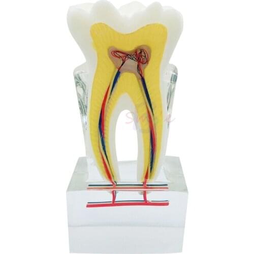 1pcs Dental Nerve Anatomy Teaching Tooth Model Six times Pathological Dental Tooth Teeth Anatomy Model