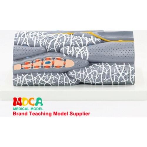 Teaching of Muscle Anatomy Medicine MPHJ001 for Streamless Rhabdomyomegaly Model of Smooth Muscle