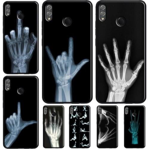 X-ray Hand Bones Case For Huawei Honor 8X 9X 7X 20 Pro 9 10 Lite 10i 8C 8A 7A V20 Y6 Y7 Y9 2019 Nova 5T