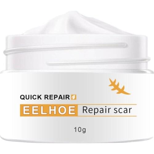 Plant Scar Repair Cream Acne Scar Stretch Mark Remover For Burn Scars Old Postoperative Removal Skin Smoothing
