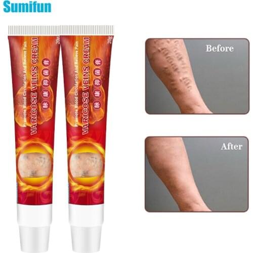 Sumifun 1pcs Varicose Veins Cream Varicose Veins Ointment Natural Treatment Phlebitis Angiitis Spider Leg Treatment Cream P1109