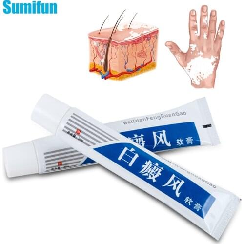 1Pcs 30g Vitiligotreament Antibacterial Cream Psoriasis Localized Vitiligo Ointment White Spot Mycosis Leukoplakia Treatment