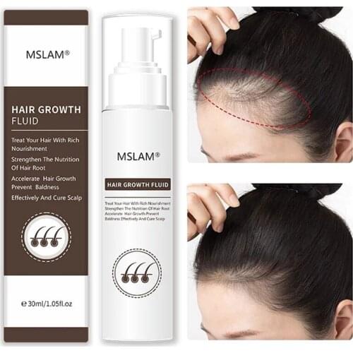 Hair Growth Fluid Moisturizing Prevent Hair Broken Rough Nourish Smooth Polygonum Multiflorum Root Scalp Treatment Hair Care