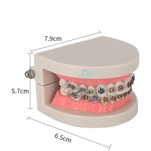 1pc Dental Orthodontic Tooth Model TreatmentWith Ortho Metal Ceramic Bracket Arch Wire Buccal Tube Ligature Ties