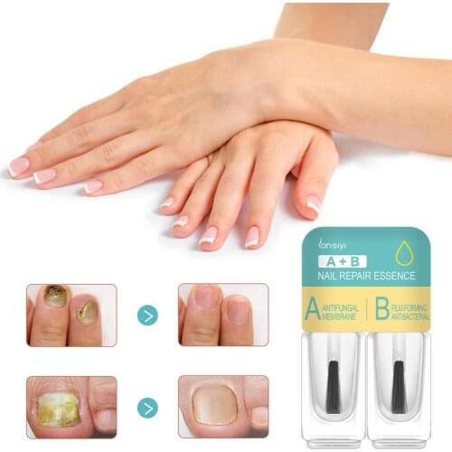 Safe Nail Care Solution Nutrient Solution Nail Repair Essence Dried Nails Moisturizing Nutrient Solution Regenerate&Revive Nail