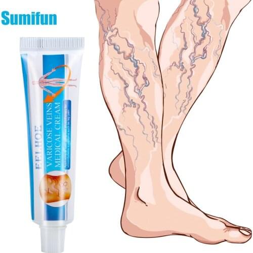 1PCS Varicose Veins Treatment Cream HOT SALE 100% Original Vasculitis Phlebitis Spider Pain Relief Ointment Health Care