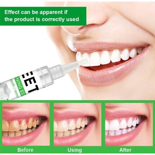 NEW Teeth Whitening Pen 4ml Tooth Gel White Teeth Kit Cleaning Bleaching Remove Stains Oral Hygiene Whitening TSLM2