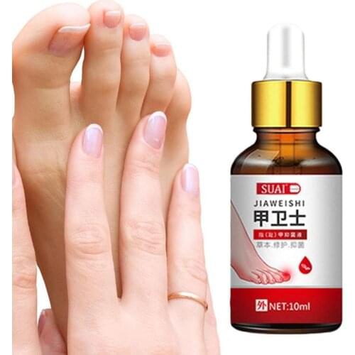 Nail Fungal Treatment Feet Care Essence Nail Foot Whitening Toe Nail Fungus Removal Gel Anti Infection Paronychia Onychomycosis