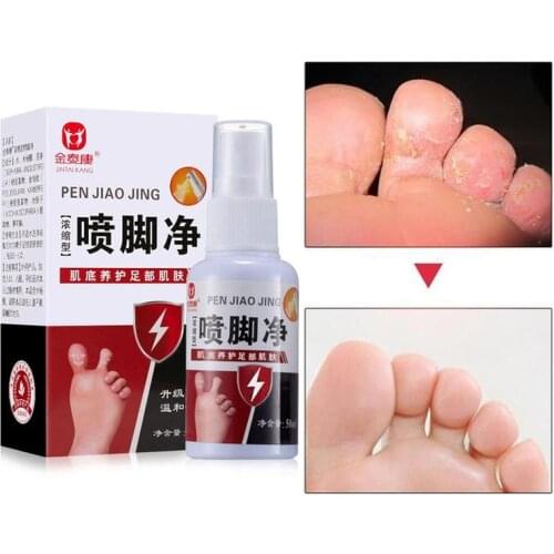 1 pcs Anti-Beriberi Spray Foot Deodorant Odor Remover Athletes Anti-fall Anti-bacteria Fungus Feet Care Supplies