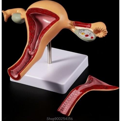 Human Pathological Uterus Ovary Model Anatomical Anatomy Disease Pathology Lesion For Teaching O27 20 Dropship
