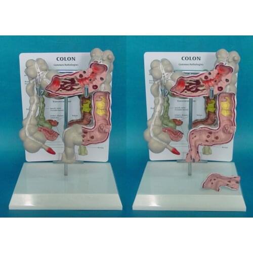 Colon structure model morbid large intestine display human digestive tract anorectal rectal model duodenum