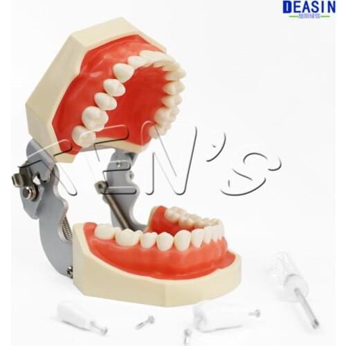 1 pcs Dental removable dental model dental tooth arrangement practice model with screw teaching simulation model