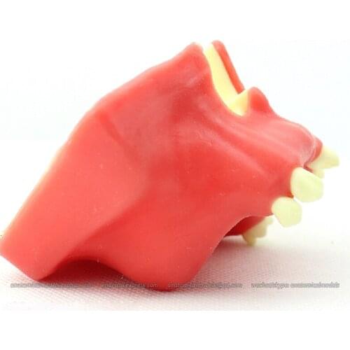 CMAM/12615 Dental- Implantation of missing teeth, Human Oral Dental Medical Teaching Anatomical Model