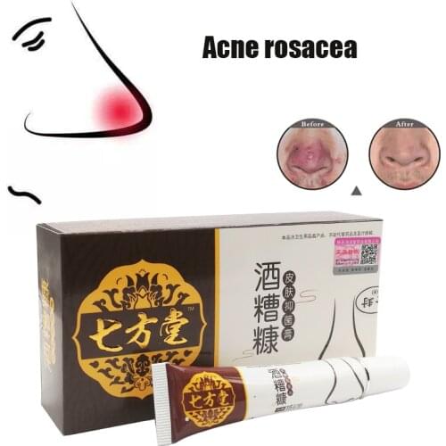 Herbal Anti Nose Mites Remove Acne Rosacea Cream Red Nose Blackhead Remover Acne Treatment Shrink Pores Face Bleaching Ointment