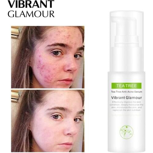 VIBRANT GLAMOUR Tea Tree Acne Treatment Serum Remove Acne Spots Oil Control Shrink Pores Repair Whitening Moisturizing Essence