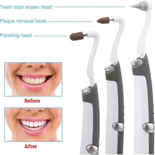 Electric Ultra-Sonic Acoustic Vibration Tooth Cleaner Scaler Tooth Calculus Remover Teeth Stains Tartar teeth Whitening